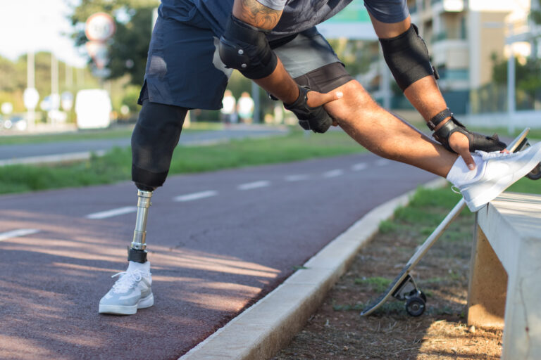 sportsman with mechanical leg getting ready for training